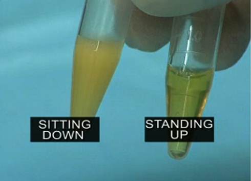 Sitting vs Standing Lipase